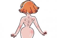 嘉兴背部吸脂效果