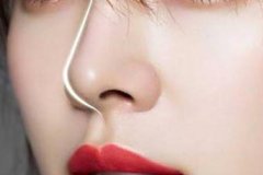 嘉兴注射隆鼻贵吗